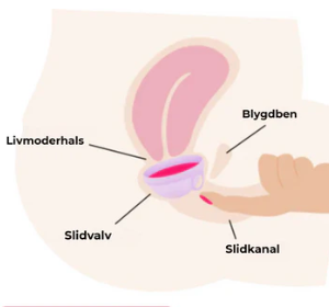 2. Plasserer seg selv